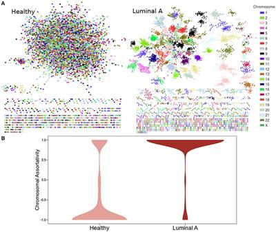 Luminal A Breast Cancer Co-expression Network: Structural and Functional Alterations